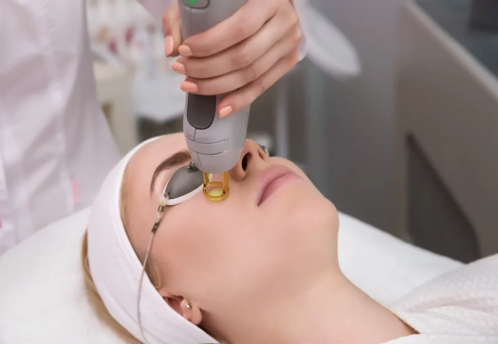 Laser Skin Resurfacing